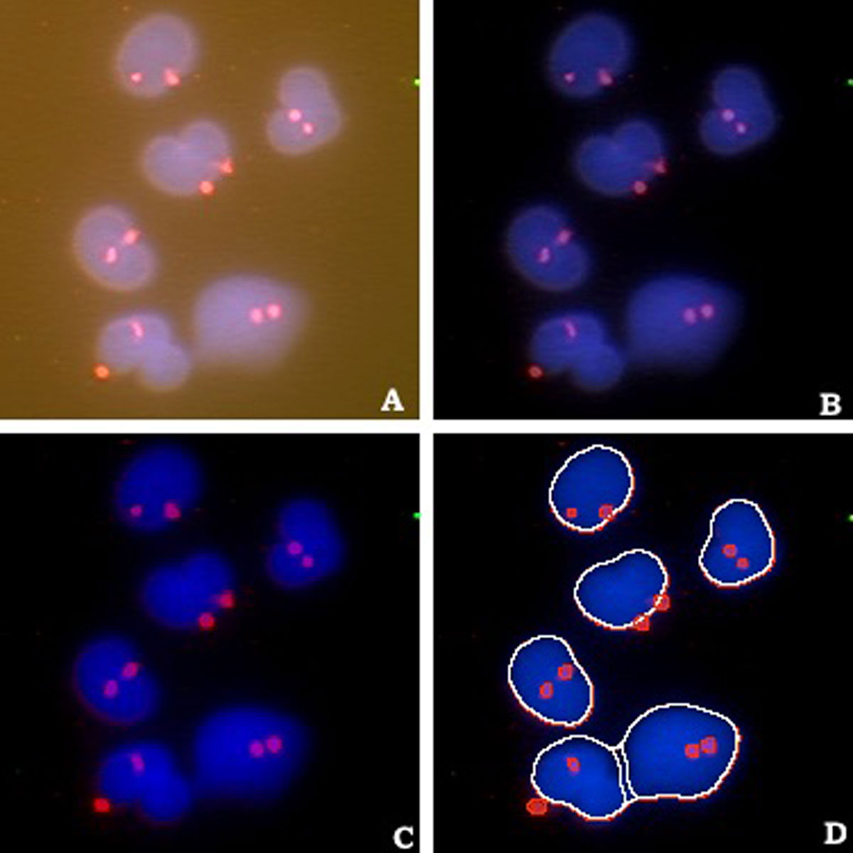 FISH image of 6 female (XX) cells